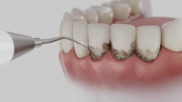 Trusted Teeth Cleaning And Checkup service in Wyndham, VA - Dentist Open Now